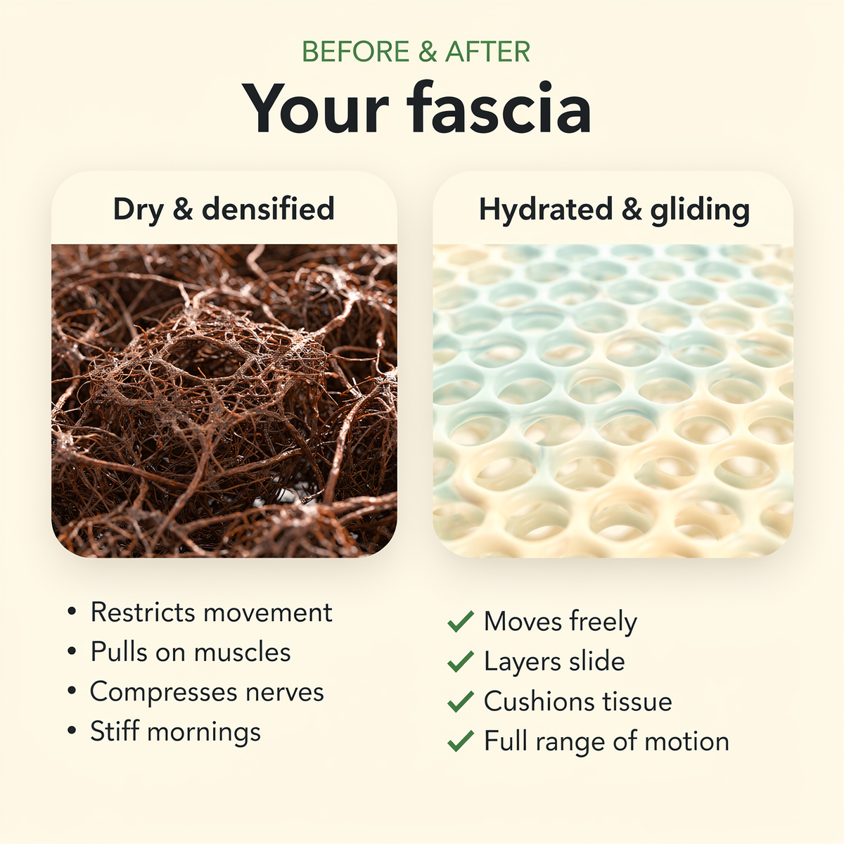 fascial